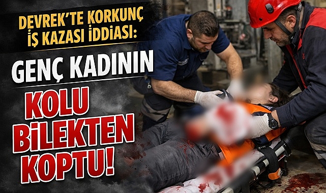 Devrek’te korkunç iş kazası! Genç kadının kolu bilekten koptu!